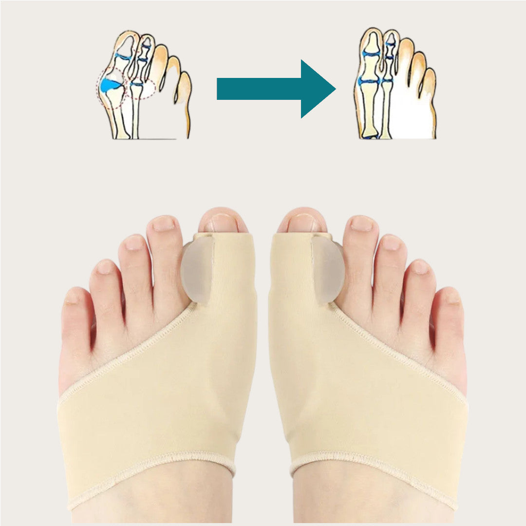 HALLLUX VALGUS STÖD